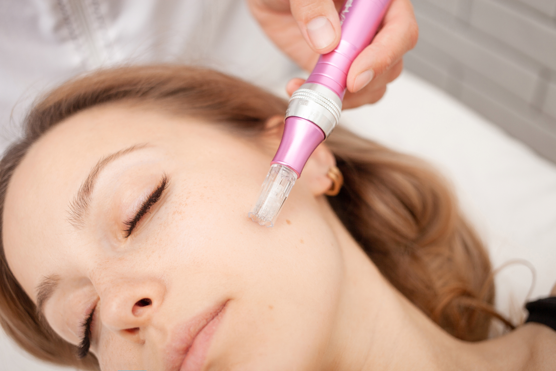 Dermapen (Microneedling)